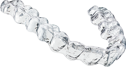 マウスピース矯正